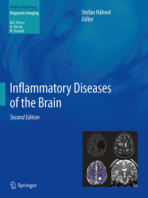 cover image of Inflammatory Diseases of the Brain